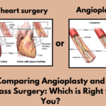 Comparing Angioplasty and Bypass Surgery: Which is Right for You?