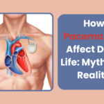 How Pacemakers Affect Daily Life: Myths vs. Reality