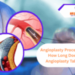 Angioplasty Procedure: How Long Does Angioplasty Take