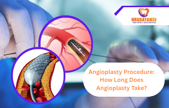 Angioplasty Procedure: How Long Does Angioplasty Take