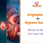 Angioplasty vs Bypass Surgery: Which Is Better for Your Heart?