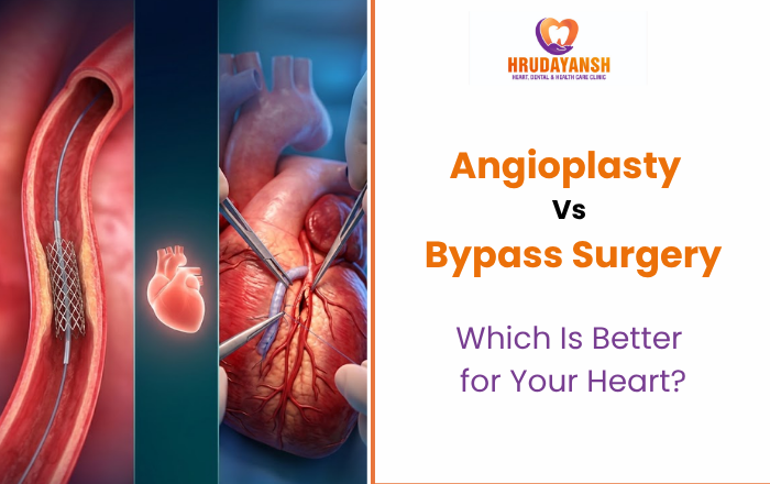 Angioplasty vs Bypass Surgery: Which Is Better for Your Heart?
