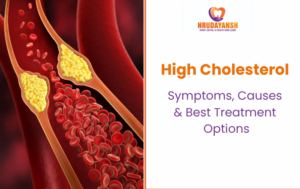 High Cholesterol: Symptoms, Causes & Best Treatment Options