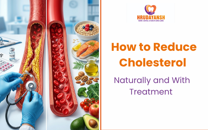 How to Reduce Cholesterol Naturally and With Treatment