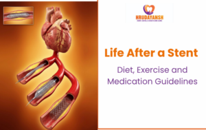 Life After a Stent: Diet, Exercise and Medication Guidelines