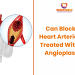 Can Blocked Heart Arteries Be Treated Without Angioplasty?