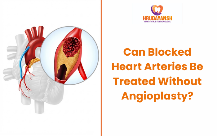 Can Blocked Heart Arteries Be Treated Without Angioplasty?